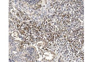IHC analysis of DAP1/DAP using anti-DAP1/DAP antibody (ABIN7602875). (DAP anticorps  (C-Term))