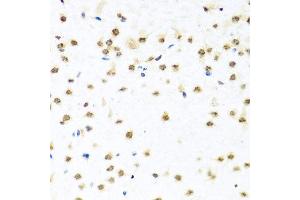 Immunohistochemistry of paraffin-embedded mouse brain using RAB3IP antibody at dilution of 1:100 (x40 lens). (RAB3IP anticorps)