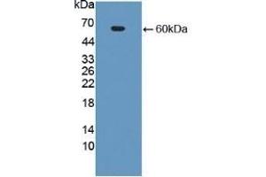 Detection of Recombinant CECR1, Human using Polyclonal Antibody to Cat Eye Syndrome Chromosome Region, Candidate 1 (CECR1) (CECR1 anticorps  (AA 30-511))