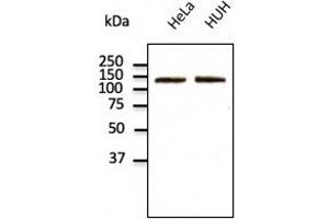 Endogenous CDH2 detected with at 1/500 dilution; lysates at 100 µg per lane and rabbit polyclonal to goat lgG (HRP) at 1/10,000 dilution. (N-Cadherin anticorps  (C-Term))