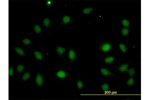 Immunofluorescence of monoclonal antibody to LASS4 on HeLa cell.