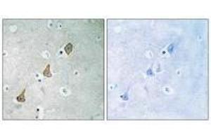 Immunohistochemistry analysis of paraffin-embedded human brain tissue using PECAM-1 (Ab-713) antibody.