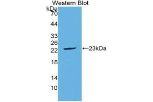Western blot analysis of the recombinant protein. (FGF21 anticorps  (AA 29-209))
