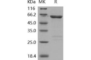 Western Blotting (WB) image for tyrosine Kinase, Non-Receptor, 2 (TNK2) protein (GST tag) (ABIN7317144) (TNK2 Protein (GST tag))
