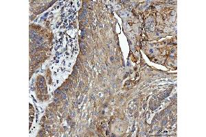 IHC analysis of GRB10 using anti-GRB10 antibody (ABIN7599160). (GRB10 anticorps  (AA 1-251))