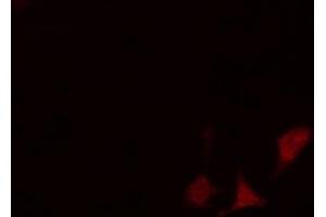 anti-ADP-Ribosylation Factor GTPase Activating Protein 3 (ARFGAP3) (C-Term) antibody