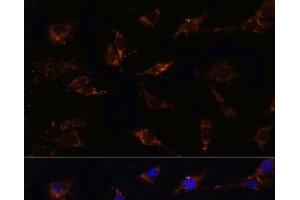 Immunofluorescence analysis of C6 cells using TGFB1 Polyclonal Antibody at dilution of 1:100. (TGFB1 anticorps)
