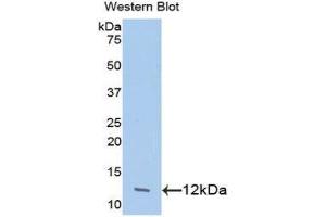 Western Blotting (WB) image for anti-Chemokine (C-C Motif) Ligand 24 (CCL24) (AA 27-119) antibody (ABIN1078373) (CCL24 anticorps  (AA 27-119))