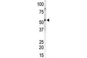 Western blot of CAMK2G and mouse heart tissue lysate