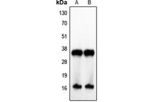Western blot analysis of IL-4 expression in Jurkat (A), human tonsil (B) whole cell lysates. (IL-4 anticorps  (Center))