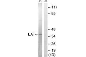 Western blot analysis of extracts from Jurkat cells, using LAT (Ab-161) Antibody. (LAT anticorps  (AA 86-135))