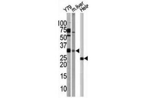 Western Blotting (WB) image for anti-ATG5 Autophagy Related 5 (ATG5) antibody (ABIN2999976) (ATG5 anticorps)