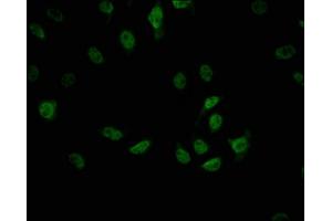Immunofluorescence staining of A549 cells with ABIN7127416 at 1:42, counter-stained with DAPI.