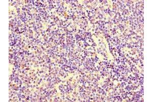 Immunohistochemistry of paraffin-embedded human lymph node tissue using ABIN7156118 at dilution of 1:100 (KPNA2 anticorps  (AA 2-285))