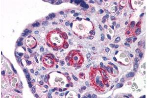 Human Placenta: Formalin-Fixed, Paraffin-Embedded (FFPE)