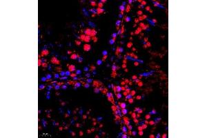 Immunofluorescence of paraffin embedded rat testis using SR140 (ABIN7076091) at dilution of 1:600 (400x lens) (SR140 anticorps)