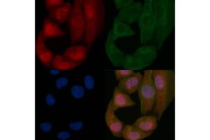 p53 Mouse Monoclonal Antibody staining Hela cells by IF/ICC. (p53 anticorps  (Internal Region))