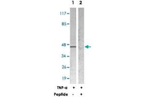 Western blot analysis of extracts from HeLa cells treated with TNF-a (20 ng/mL 5 min), using NFKBIE polyclonal antibody . (NFKBIE anticorps)