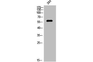 Western Blot analysis of 293 cells using Phospho-PAKγ (S20) Polyclonal Antibody (PAK2 anticorps  (pSer20))