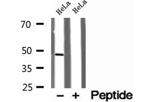 Western blot analysis of extracts of HeLa cells, using RNH1 antibody. (RNH1 anticorps  (Internal Region))