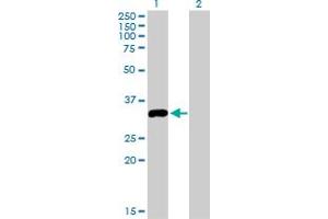 Western Blot analysis of STK16 expression in transfected 293T cell line by STK16 monoclonal antibody (M03), clone 2G6. (STK16 anticorps  (AA 1-100))