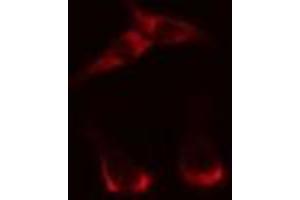 ABIN6269295 staining HepG2? (14-3-3 zeta anticorps  (Internal Region))