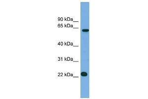 C21ORF45 antibody used at 1 ug/ml to detect target protein. (C21ORF45 anticorps  (N-Term))