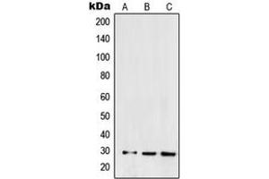 Western blot analysis of SNAI1 expression in HEK293 (A), NCIH460 (B), Caki1 (C) whole cell lysates. (SNAIL anticorps  (C-Term))