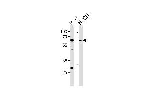 Western blot analysis of lysates from PC-3, NCCIT cell line (from left to right), using TBX22 Antibody (C-term) (ABIN6243313 and ABIN6577614).