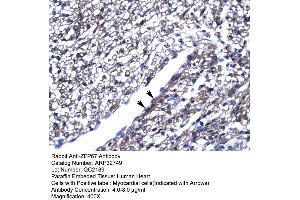 Human Heart (ZBTB7B anticorps  (Middle Region))