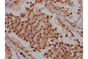 IHC image of ABIN7127351 diluted at 1:100 and staining in paraffin-embedded human testis tissue performed on a Leica BondTM system. (Recombinant ATM anticorps)