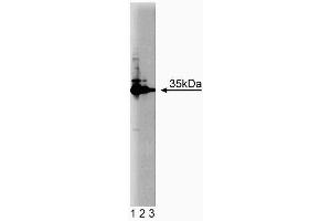 Western blot analysis of HAX-1 on Jurkat cell lysate. (HAX1 anticorps  (AA 10-148))