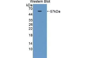 Western blot analysis of the recombinant protein. (NUAK1 anticorps  (AA 404-651))