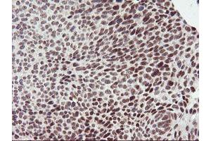 anti-Ring Finger Protein 113B (RNF113B) antibody