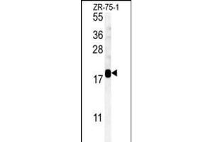 SDHAF1 anticorps  (AA 34-62)