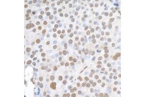 Immunohistochemistry (IHC) image for anti-Heterogeneous Nuclear Ribonucleoprotein K (HNRNPK) (C-Term) antibody (ABIN7454660)