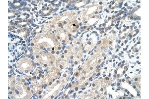 C14ORF130 antibody was used for immunohistochemistry at a concentration of 4-8 ug/ml to stain Epithelial cells of renal tubule (arrows) in Human Kidney.