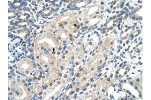 C14ORF130 antibody was used for immunohistochemistry at a concentration of 4-8 ug/ml to stain Epithelial cells of renal tubule (arrows) in Human Kidney. (UBR7 anticorps  (C-Term))