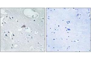 Immunohistochemistry (IHC) image for anti-Opioid Receptor, mu 1 (OPRM1) (AA 21-70) antibody (ABIN2890957) (Mu Opioid Receptor 1 anticorps  (AA 21-70))