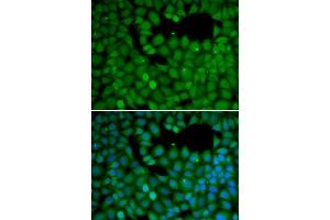 Immunofluorescence (IF) image for anti-Neuroepithelial Cell Transforming 1 (NET1) (AA 1-300) antibody (ABIN1513253) (NET1 anticorps  (AA 1-300))
