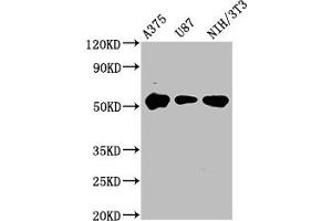 Western Blot Positive WB detected in: A375 whole cell lysate, U87 whole cell lysate, NIH/3T3 whole cell lysate All lanes: STK3 antibody at 3.