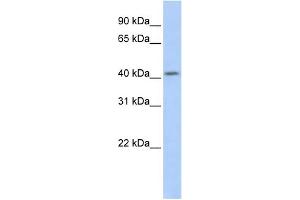 WB Suggested Anti-SOHLH1 Antibody Titration:  0. (SOHLH1 anticorps  (Middle Region))