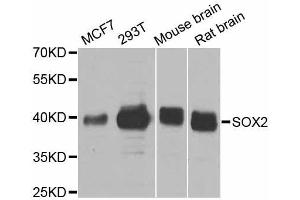 Western blot analysis of extracts of various cell lines, using SOX2 antibody.