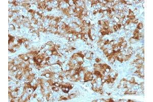 Formalin-fixed, paraffin-embedded Adrenal Gland stained with Chromogranin A Monoclonal Antibody (CGA/413+ CHGA/777+ CHGA/798) (Chromogranin A anticorps)