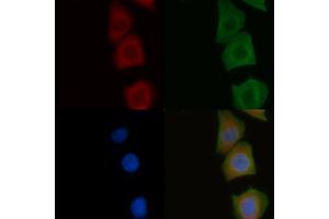ABIN6258141 and ABIN6275933 staining Hela cells by IF/ICC. (S1PR2 anticorps  (Internal Region))