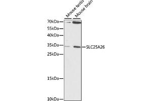 Western blot analysis of extracts of various cell lines, using SLC25 antibody (ABIN7270437) at 1:1000 dilution. (SLC25A26 anticorps  (AA 105-185))