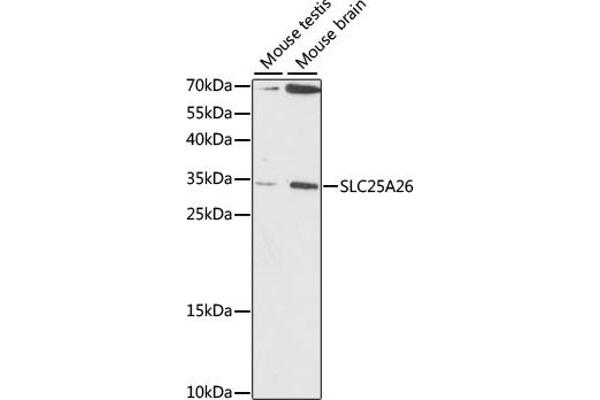 SLC25A26 anticorps  (AA 105-185)