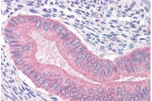 Human Uterus: Formalin-Fixed, Paraffin-Embedded (FFPE) (CTNNA1 anticorps  (AA 871-883))