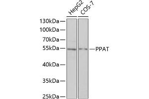 Western blot analysis of extracts of various cell lines, using PPAT antibody (ABIN6128488, ABIN6146009, ABIN6146010 and ABIN6222409) at 1:1000 dilution.