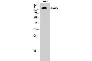 Western Blotting (WB) image for anti-Histone Deacetylase 5 (HDAC5) (Tyr512) antibody (ABIN3184988) (HDAC5 anticorps  (Tyr512))